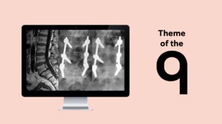 Open posterolateral fusion